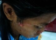 Kejamnya Ibu Tiri Terjadi di Kota Batam, Gadis Usia 16 Tahun “Bonyok” di Aniaya