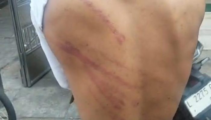 Diduga Jadi Korban Kekerasan, Tiga Anak Laporkan Penganiayaan ke Polisi