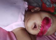 Balita Idap Kanker, Orangtua Butuh Uluran Tangan Buat Berobat