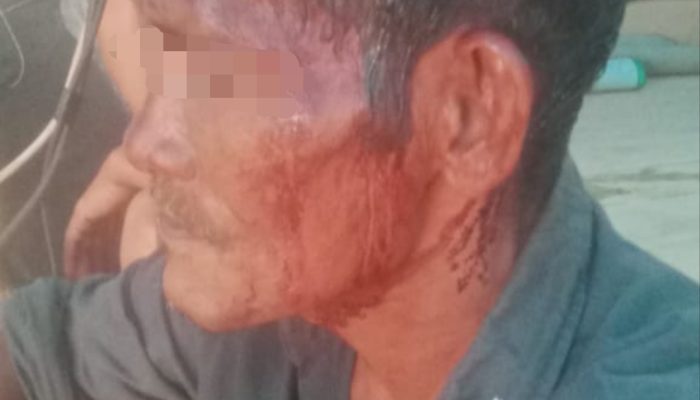 Rakyat Kecil Tertindas di Tanah Sendiri Protes PETI Ilegal,Darso Harahap, Malah Dibantai,10 Hektare Lahan di Madina Diduga Dirampok Mafia Tambang